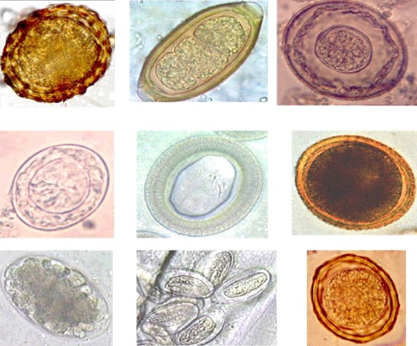 Image collection of parasitic eggs